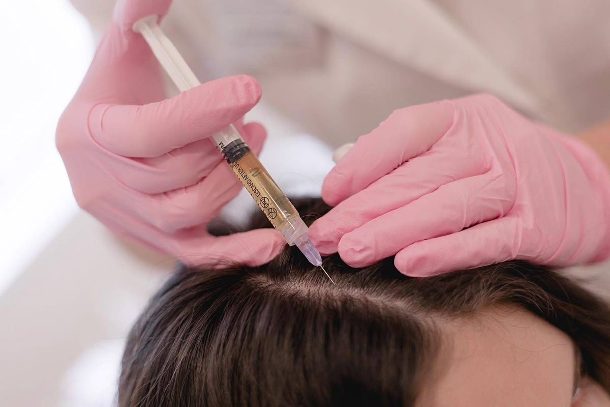 Does PRP Really Help Hair Regrowth?