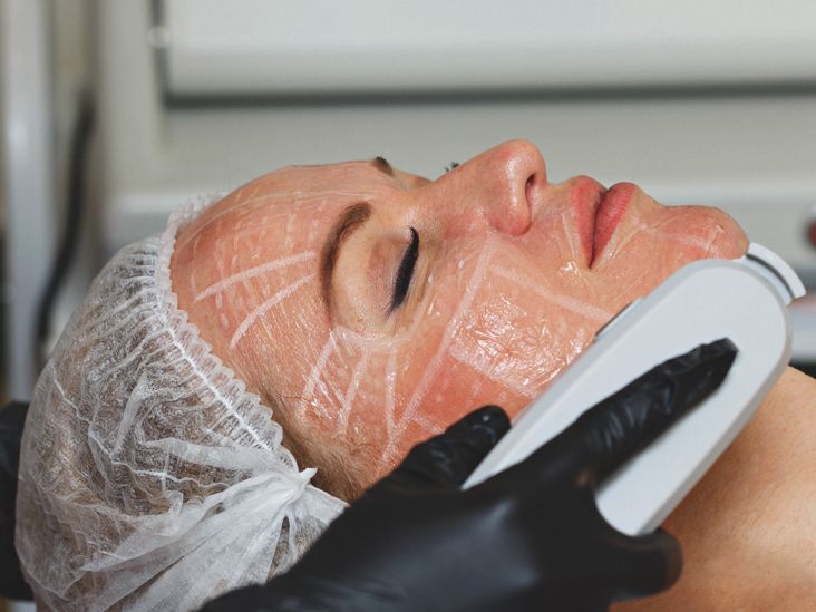 Skin Tightening Without Surgery: What Are Your Options?