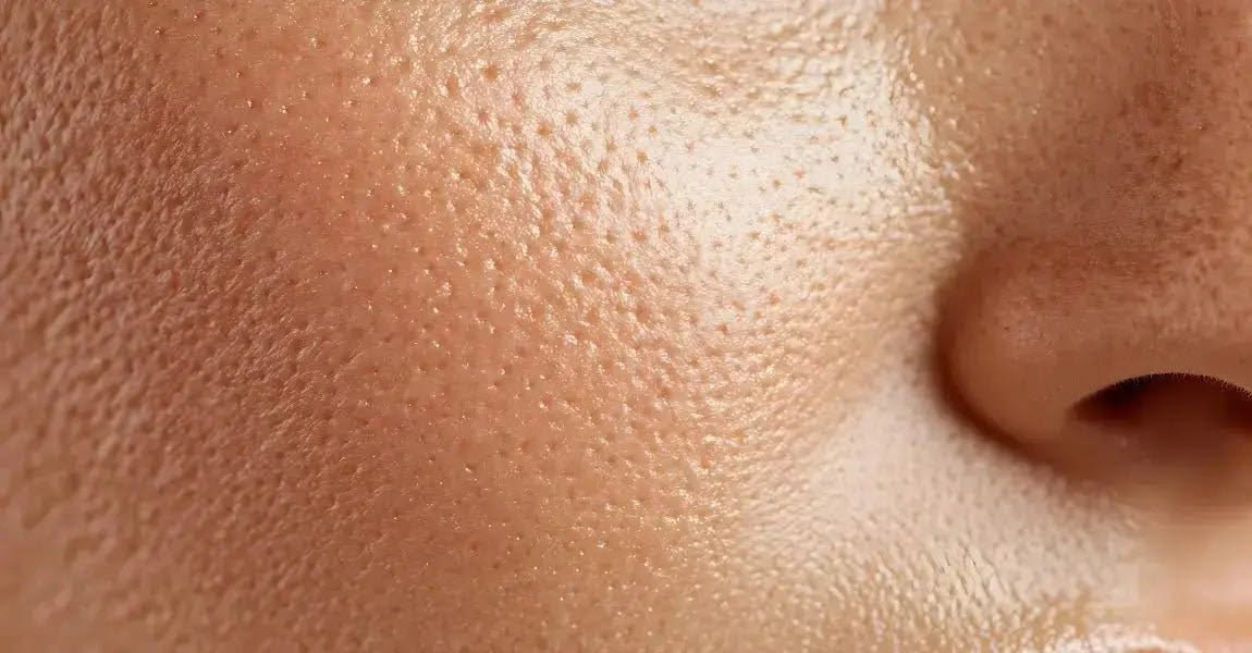 Open Pores: Why They Happen and How to Minimize Them