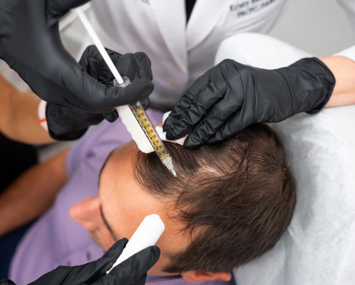 What Is GFC Hair Treatment and Who Can Benefit?