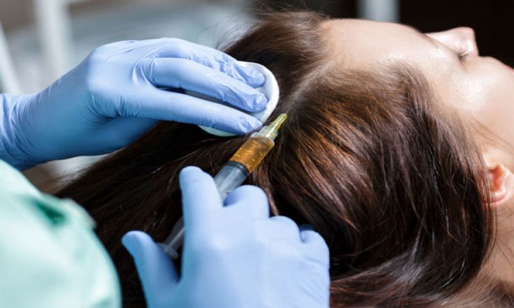 Hair PRP Therapy