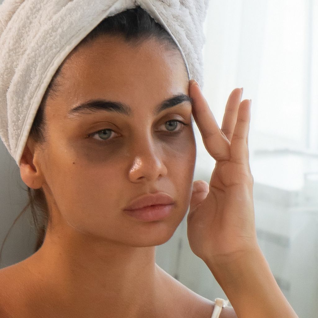 Dark Circles Treatment